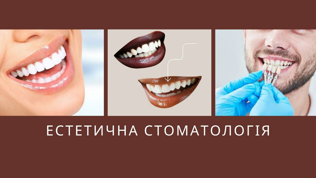 Естетична стоматологія